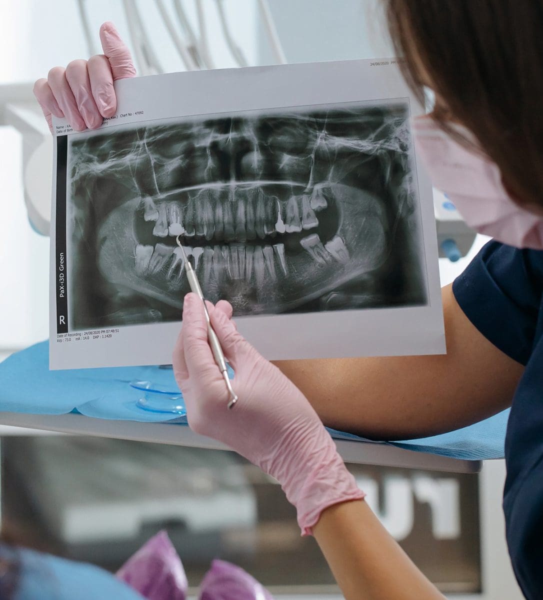 X-Rays