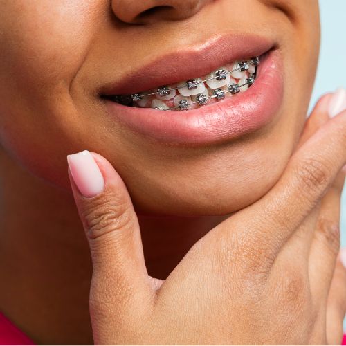 Braces & Aligners